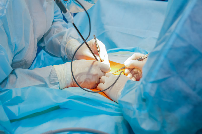 Complex laparoscopic operation on a peritoneal cavity is carried out in four hands